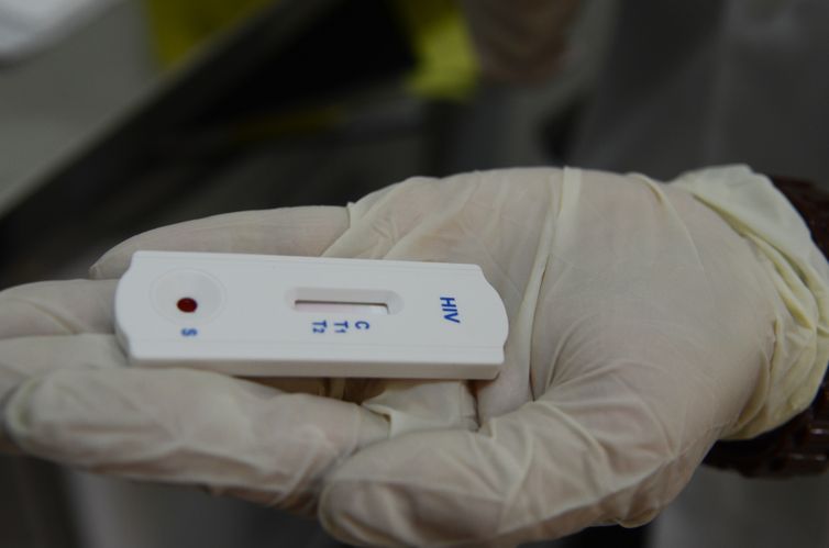 Saúde orienta farmácias sobre testes para HIV, sífilis e hepatites